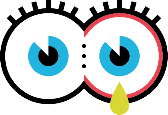 Illustration d'un oeil avec écoulement purulent pour illustrer la conjonctivite bactérienne chez l'enfant